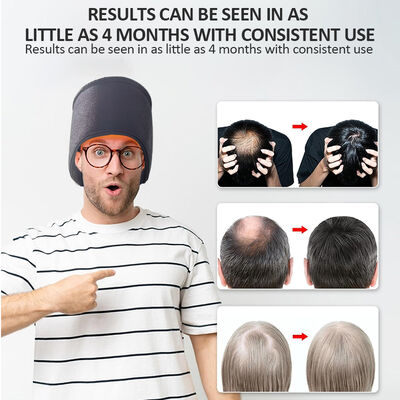 660nm cappello per la crescita dei capelli con terapia a luce rossa e 270 cappello per la luce rossa e la terapia laser